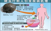 皮肤科普知识之蜱虫